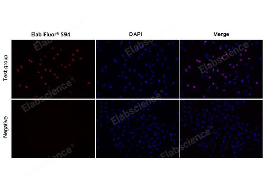 Test: Hela cells were treated with 10 μM EdU for 2 hours. Negative: Hela cells without EdU.