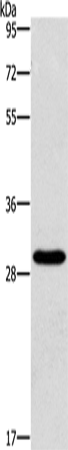 Anti-Human/Mouse/Rat BCL10 Antibody - ABMIUM