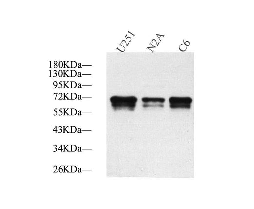 Western Blot analysis of various samples using TH Polyclonal Antibody at dilution of 1:1000.