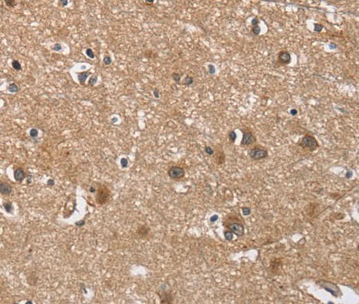 Anti-Human BUB1 Antibody - ABMIUM
