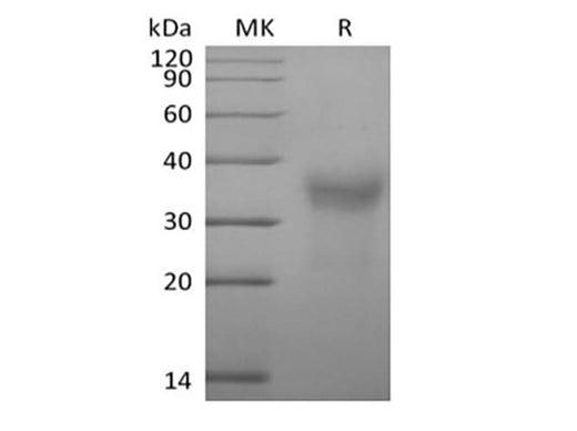 Recombinant Cynomolgus CD7/Leu-9 (C-6His) - ABMIUM