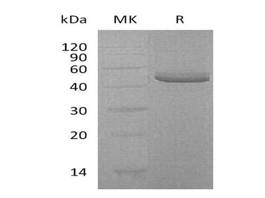 Recombinant Human TRAIL R2/TNFRSF10B Protein (Fc & His Tag) - ABMIUM