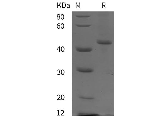 SDS-PAGE analysis of Human AMPK1 proteins, 2 μg/lane of Recombinant Human AMPK1 proteins was resolved with SDS-PAGE under reducing conditions, showing bands at 45 kDa.