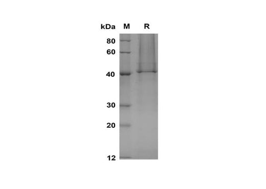 SDS-PAGE analysis of Human PKAγcat proteins, 2 μg/lane of Recombinant Human PKAγcat proteins was resolved with SDS-PAGE under reducing conditions, showing bands at 40 kDa.