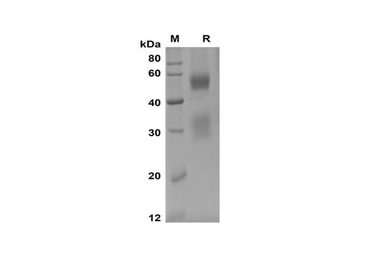 SDS-PAGE analysis of Mouse CD8a/Lyt2 proteins, 2 μg/lane of Recombinant Mouse CD8a/Lyt2 proteins was resolved with SDS-PAGE under reducing conditions, showing bands at 50-60 kDa.