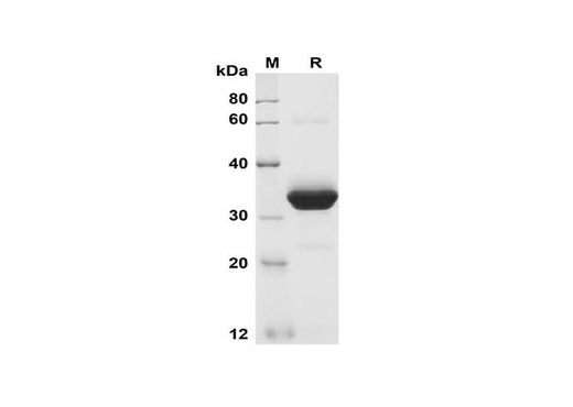 SDS-PAGE analysis of Mouse Cripto-1 proteins, 2 μg/lane of Recombinant Mouse Cripto-1 proteins was resolved with SDS-PAGE under reducing conditions, showing bands at 35 kDa.