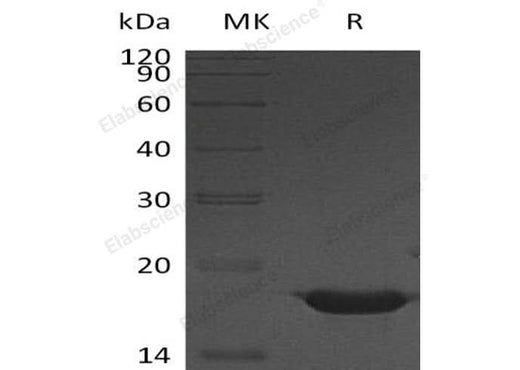 Recombinant Human YY1 Protein (His Tag) - ABMIUM
