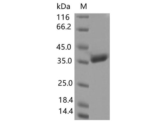 Recombinant SARS-CoV-2 Spike RBD(A344S)(His Tag) - ABMIUM