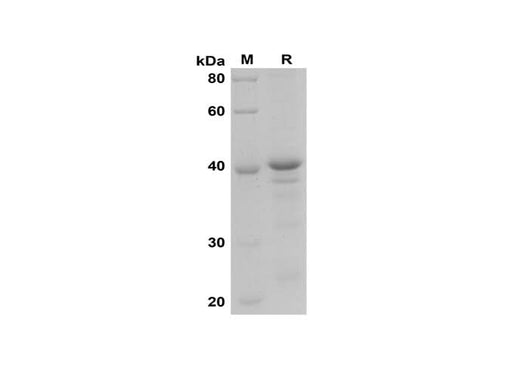 SDS-PAGE analysis of Rat Lamin B1 proteins, 2 μg/lane of Recombinant Rat Lamin B1 proteins was resolved with SDS-PAGE under reducing conditions, showing bands at 42 kDa.
