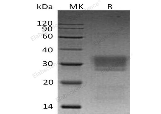 Recombinant Human ULBP2/N2DL-2 Protein (His Tag) - ABMIUM