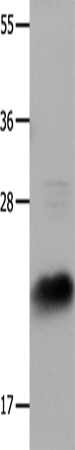 Anti-Human IL18 Antibody - ABMIUM