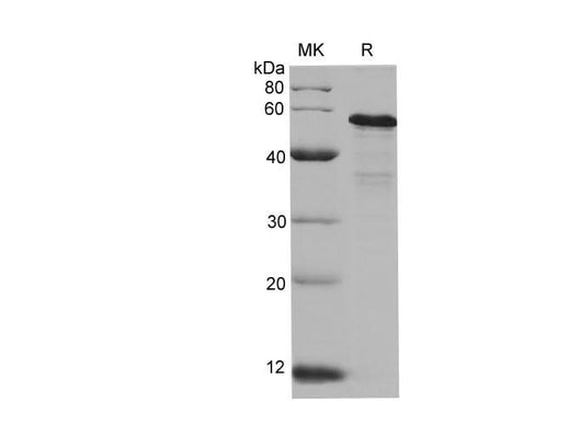 SDS-PAGE analysis of Human pan-AKT proteins, 2 μg/lane of Recombinant Human pan-AKT proteins was resolved with SDS-PAGE under reducing conditions, showing bands at 53-58 kDa.
