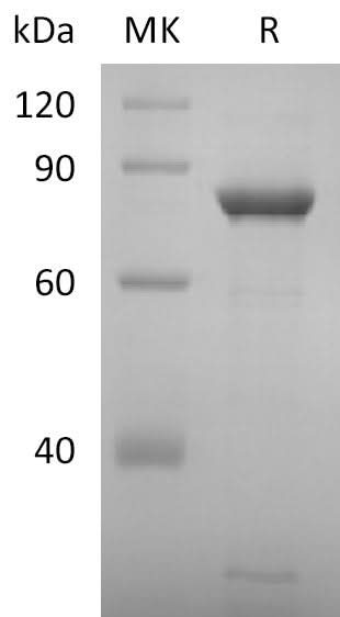 Recombinant SARS-CoV-2 NSP2 Protein (His Tag) - ABMIUM