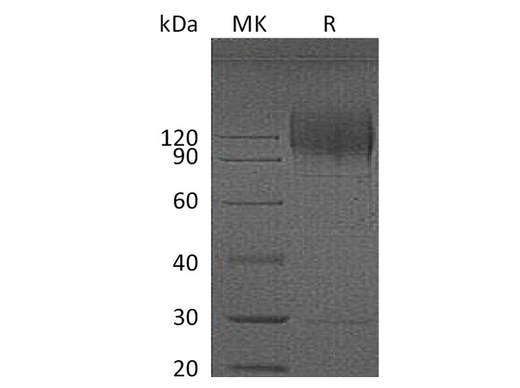 Recombinant HIV gp120 Protein (His Tag) - ABMIUM