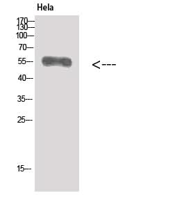 Western Blot analysis of Hela cells using Vimentin Polyclonal Antibody at dilution of 1:500.