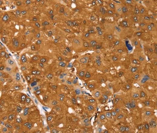 Anti-Human SSTR3 Antibody - ABMIUM