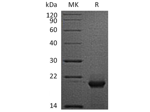 Recombinant Human FTH Protein - ABMIUM