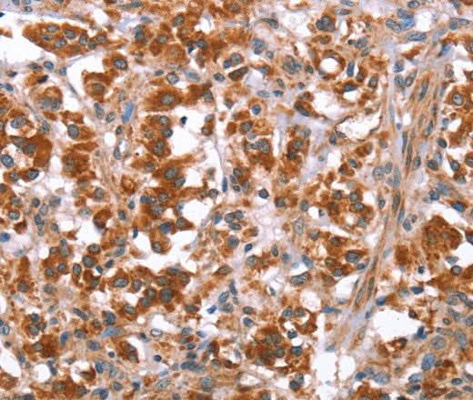 Anti-Human GLMN Antibody - ABMIUM
