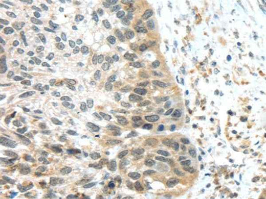 Anti-Human TSPY1/3 Antibody - ABMIUM