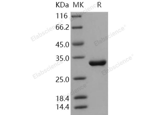 Recombinant Human HAGH/GLO2/Glyoxalase II Protein (His Tag) - ABMIUM