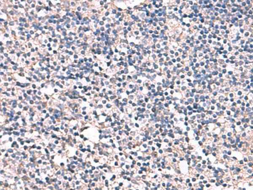Anti-Human ESM1 Antibody