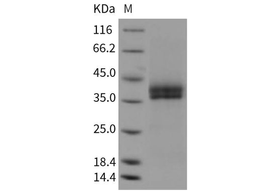 Recombinant Mouse Kallikrein 11/KLK11 Protein (His Tag) - ABMIUM