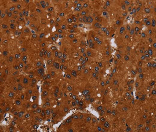 Anti-Human/Mouse NOX3 Antibody - ABMIUM