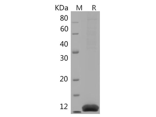 SDS-PAGE analysis of Human IL-2 proteins, 2 μg/lane of Recombinant Human IL-2 proteins was resolved with SDS-PAGE under reducing conditions, showing bands at 17 kDa.