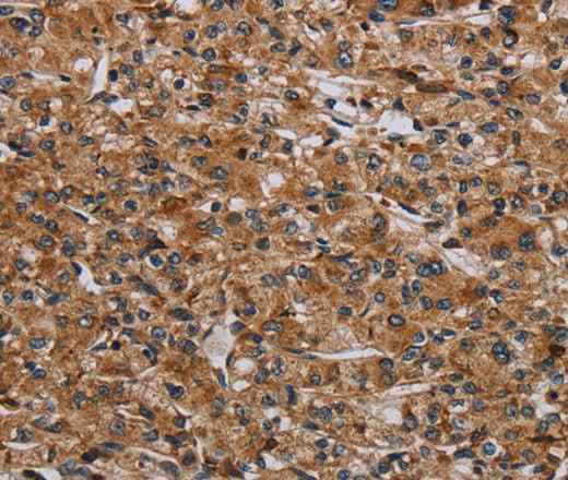 Anti-Human/Mouse p70 S6 kinase beta Antibody