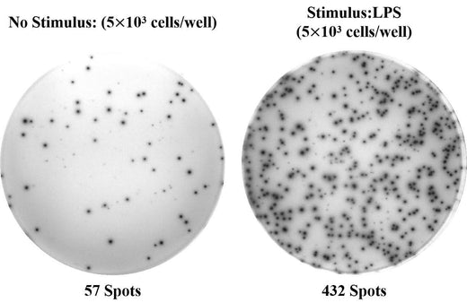 Human IL-1β (Interleukin 1β) ELISPOT Kit - ABMIUM