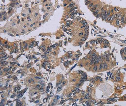 Anti-Human CCL1 Antibody