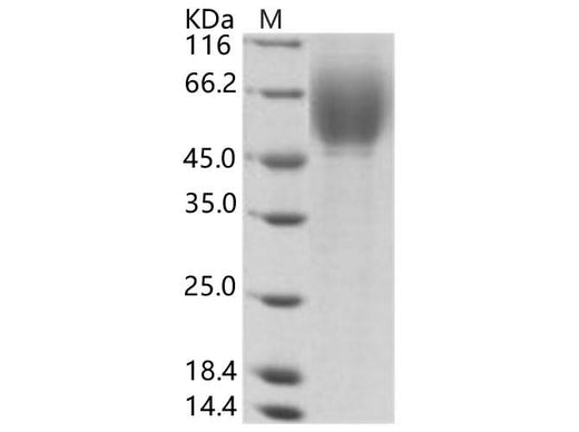 Recombinant HCV (HCV-1a) E2 Protein (His Tag) - ABMIUM