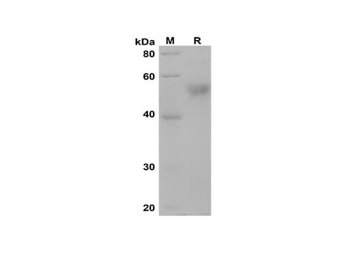 SDS-PAGE analysis of Human MAP2 proteins, 2 μg/lane of Recombinant Human MAP2 proteins was resolved with SDS-PAGE under reducing conditions, showing bands at 50 kDa.