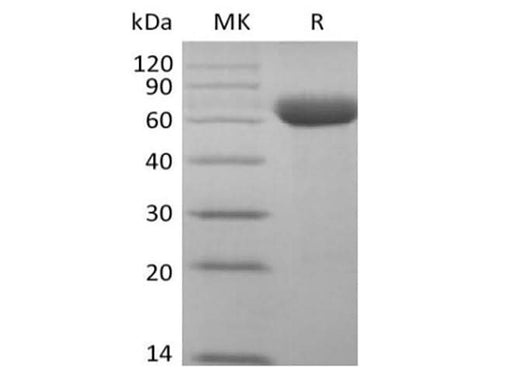 Recombinant Cynomolgus Sialic acid-binding Ig-like lectin 15/Siglec-15/CD33L3 (C-Fc) - ABMIUM