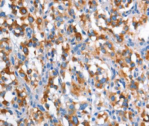 Anti-Human CD226 Antibody