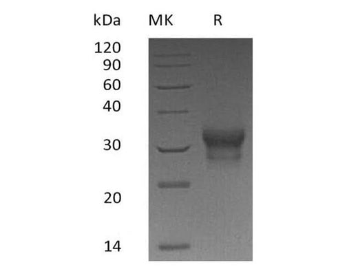 Recombinant Human IFN-λ1/IL-29 Protein (His Tag) - ABMIUM