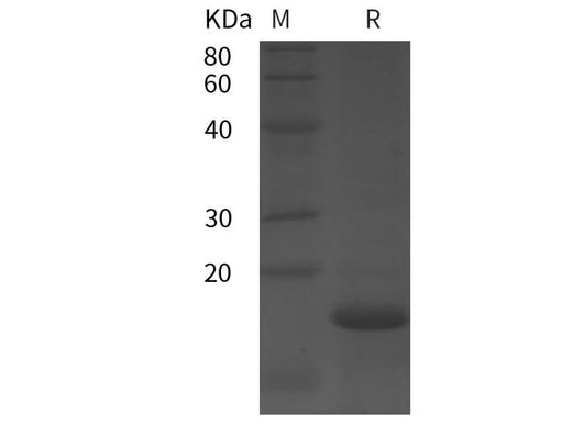 SDS-PAGE analysis of Human bFGF/FGF2 proteins, 2 μg/lane of Recombinant Human bFGF/FGF2 proteins was resolved with SDS-PAGE under reducing conditions, showing bands at 17 kDa.