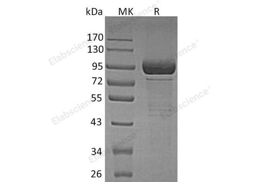 Recombinant Human β-Galactosidase/GLB1 Protein (His Tag) - ABMIUM