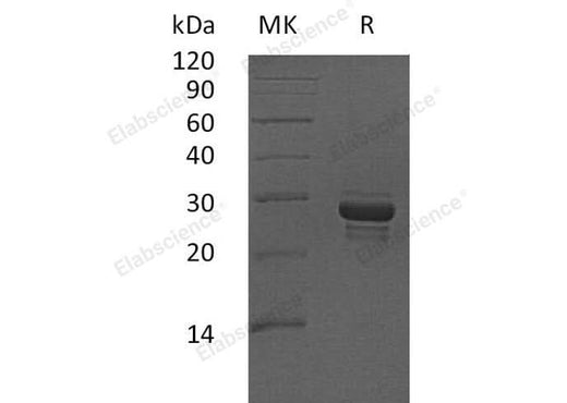 Recombinant Human CALCB Protein (aa 1-118, Fc Tag) - ABMIUM