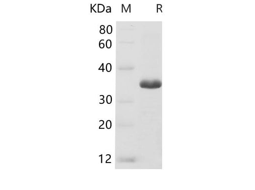 SDS-PAGE analysis of Human GAPDH proteins, 2 μg/lane of Recombinant Human GAPDH proteins was resolved with SDS-PAGE under reducing conditions, showing bands at 34-37 kDa.
