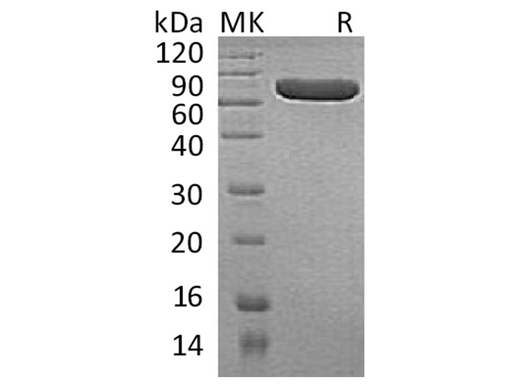 Recombinant Human Placental Alkaline Phosphatase 1/ALPP Protein (His Tag) - ABMIUM