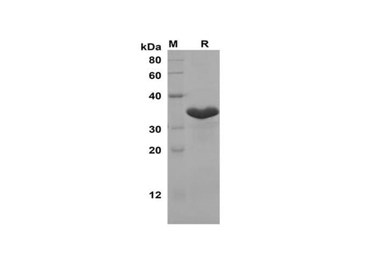 SDS-PAGE analysis of Rat IL-2 proteins, 2 μg/lane of Recombinant Rat IL-2 proteins was resolved with SDS-PAGE under reducing conditions, showing bands at 35 kDa.
