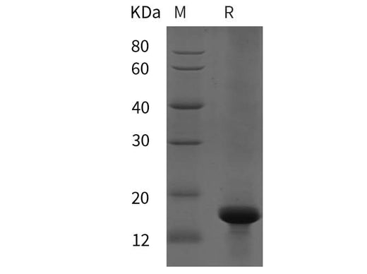 SDS-PAGE analysis of Rat FoxJ1 proteins, 2 μg/lane of Recombinant Rat FoxJ1 proteins was resolved with SDS-PAGE under reducing conditions, showing bands at 15 kDa.