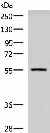 Western blot analysis of Human cerebella tissue lysate using CAMKK1 Polyclonal Antibody at dilution of 1:700
