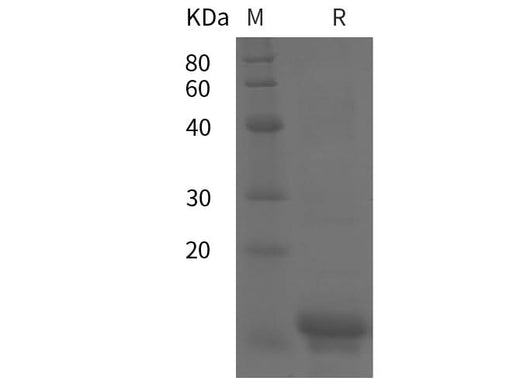 SDS-PAGE analysis of Human IL18 proteins, 2 μg/lane of Recombinant Human IL18 proteins was resolved with SDS-PAGE under reducing conditions, showing bands at 12 kDa.