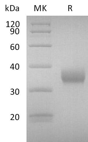 Recombinant SARS-CoV-2 Spike RBD (N439K)(His Tag) - ABMIUM