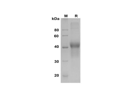 SDS-PAGE analysis of Human M-CSF proteins, 2 μg/lane of Recombinant Human M-CSF proteins was resolved with SDS-PAGE under reducing conditions, showing bands at 40-45 kDa.