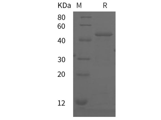SDS-PAGE analysis of Human VCAM-1/CD106 proteins, 2 μg/lane of Recombinant Human VCAM-1/CD106 proteins was resolved with SDS-PAGE under reducing conditions, showing bands at 45 kDa.