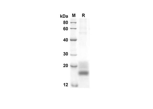 SDS-PAGE analysis of Rat GM-CSF proteins, 2 μg/lane of Recombinant Rat GM-CSF proteins was resolved with an SDS-PAGE under reducing conditions, showing bands at 15.7 kDa.