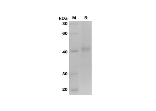 SDS-PAGE analysis of Mouse Adiponectin proteins, 2 μg/lane of Recombinant Mouse Adiponectin proteins was resolved with SDS-PAGE under reducing conditions, showing bands at 42 kDa.